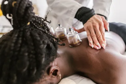 Cupping